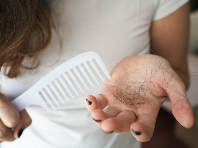 Frau Haarausfall Bürste Haare