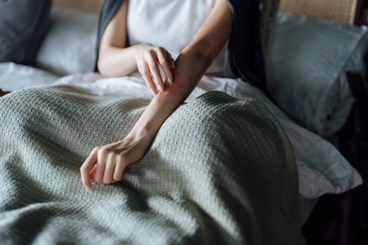 mückenstich frau schmerz bett decke