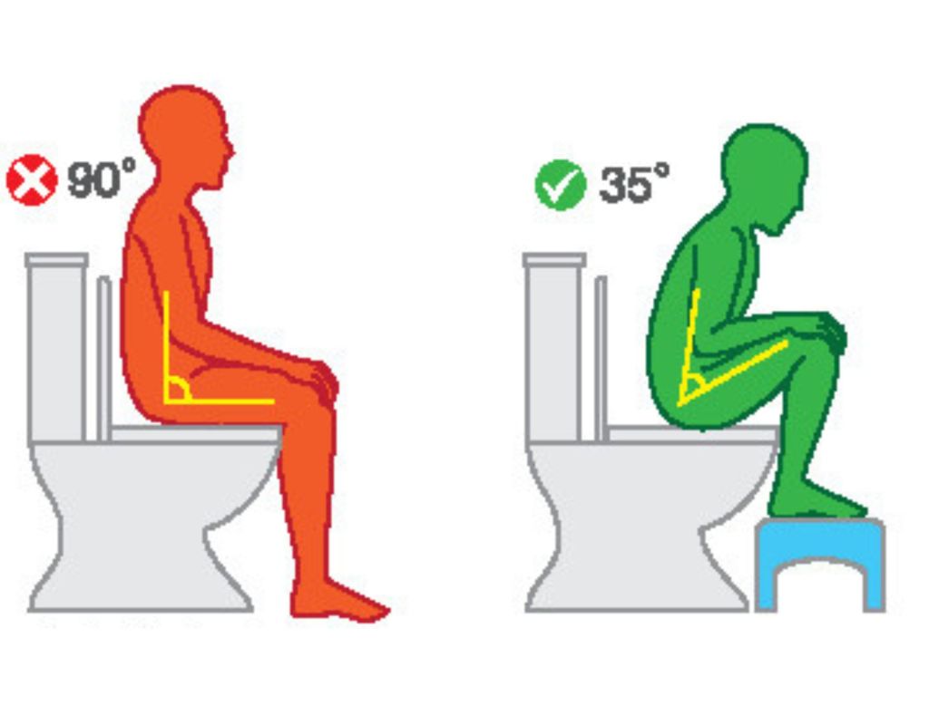 Stuhlgang auf dem Klo: Besser mit Hocker