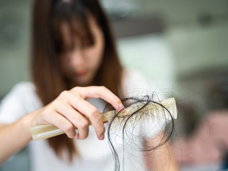 Frau mit Haarausfall