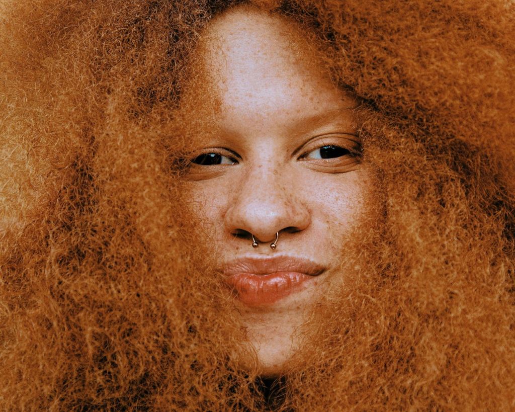 Frau mit großer breiter Nase