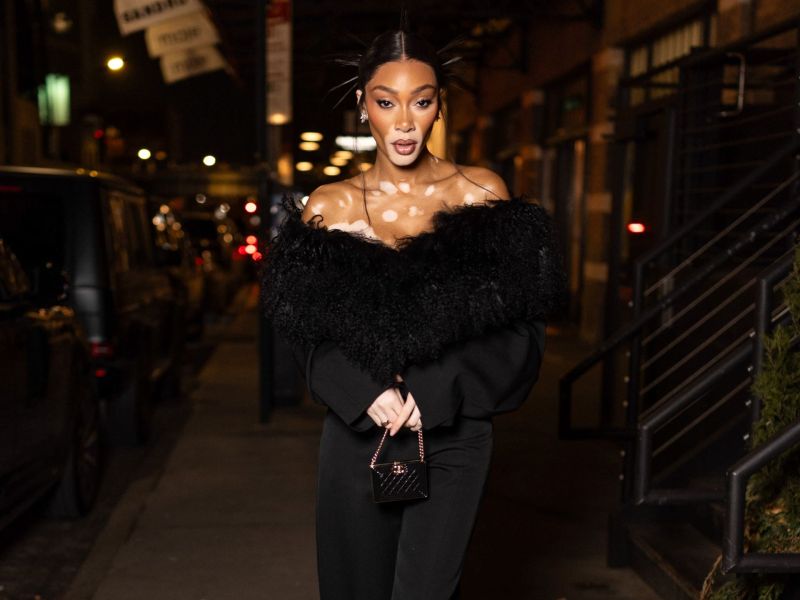 Winnie Harlow